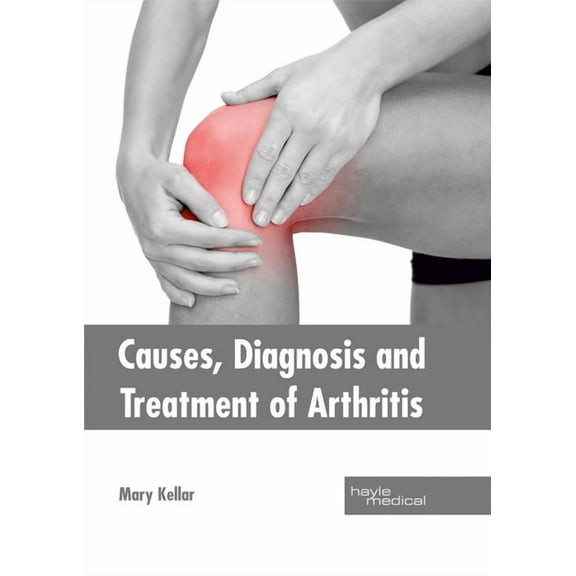 Causes, Diagnosis and Treatment of Arthritis, (Hardcover)