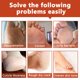 thumbnail image 4 of Enfermería Del Pie 1 par de mascarillas exfoliantes para pies, pedicura, removedor de piel muerta (coco) Ygjytge Cuidado Belleza, 4 of 6