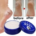 thumbnail image 2 of 80/33/55/85ml Chilblain Frostbite Inflammation Warming Effective UK Cream N C1V3, 2 of 7
