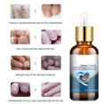 thumbnail image 4 of Toenail Treatment Gel, Easy To Apply Fingernail Repair Solution Moisturizing Strengthening  for Thick Nails, 4 of 8