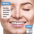 thumbnail image 3 of Teami Beauty Facial Mask - Moisturizing Face Mask Skin Care - Anti Acne & Blackhead Remover with Butterfly Pea Flower & Kaolin Clay - Deep Cleansing Face Mask for Oily, Dry, or Sensitive Skin, 3 of 9