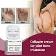 BONINGGG Joint Collagen Joint Soreness And Body Joint Care Collagen