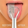 thumbnail image 4 of Soug Tongue Scraper for Adults to Reduce Bad Breath, Stainless Steel Tongue Cleaners, Metal Tongue Scraper, Fresh Breath Tongue Cleaner New, 4 of 8