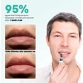 thumbnail image 3 of Crema de labios ABERA Abera Fordyce con HPR para labios secos, 20 ml, 3 of 7