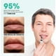 thumbnail image 3 of Crema de labios ABERA Abera Fordyce con HPR para labios secos, 20 ml, 3 of 7