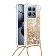 thumbnail image 2 of Funda FOXDOCK para Xiaomi 14T con Cuerda Ajustable, Brillo Líquido, Protección Antigolpes y Lente – Ideal para Regalo, 2 of 6