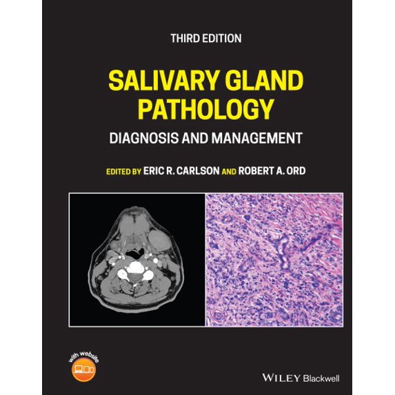 Pre-Owned Salivary Gland Pathology: Diagnosis and Management