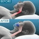 thumbnail image 4 of Advanced Anti-Snoring Mouthpiece - Double-Layer Night Guard for Men Women, Teeth Grinding & Sleep Apnea Relief, 4 of 5