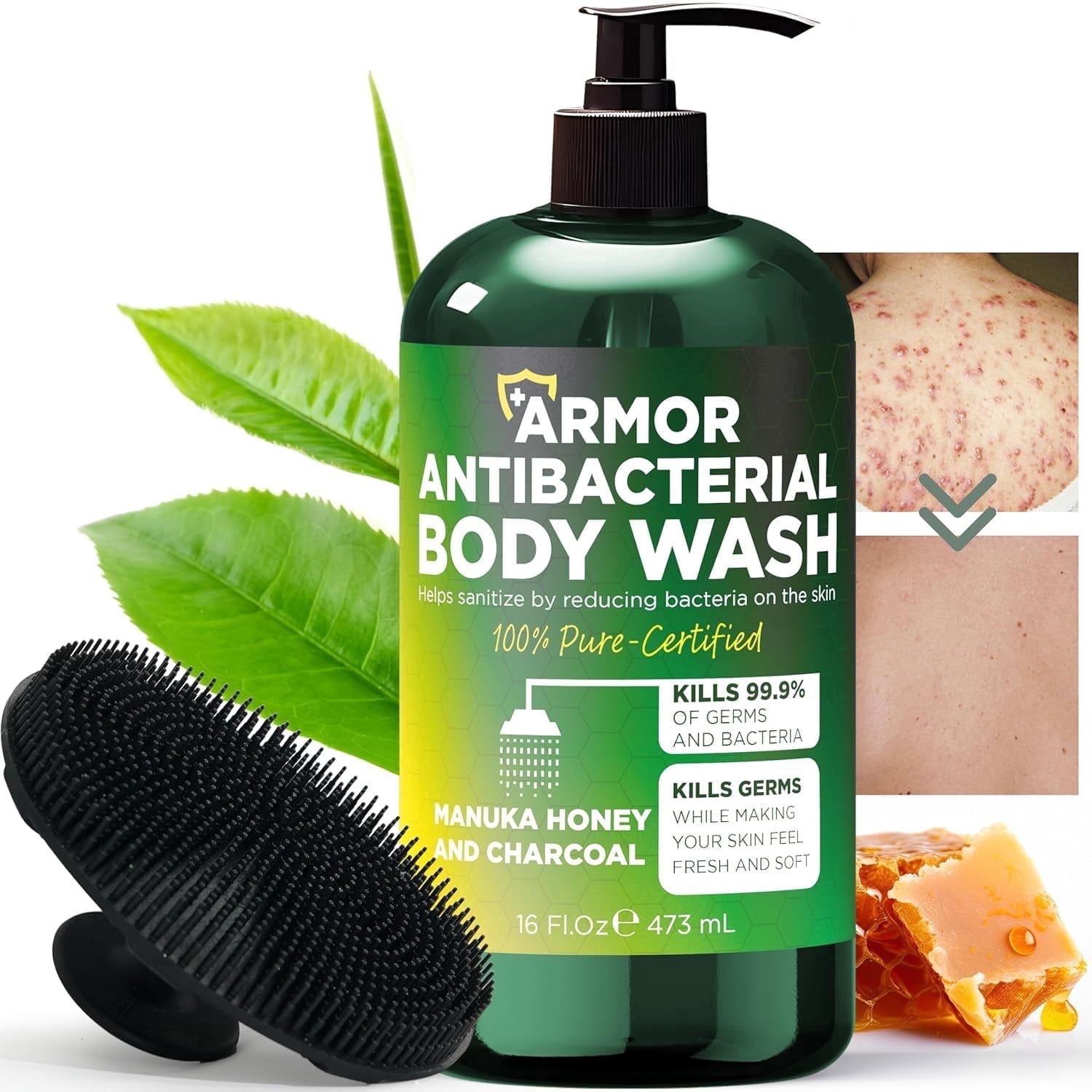 Antibacterial Body Wash | Antibacterial Soap for Men & Women | Kills 99.9% of Germs & Bacteria | Helps with Back Acne, Body Odor & Skin Irritation | Manuka Honey & Charcoal | Includes Scrubber16 fl o