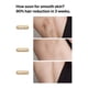 thumbnail image 5 of Depilación láser Ulike Sapphire Air 3 IPL para mujeres y hombres, 5 of 9