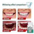 thumbnail image 2 of Teeth Whitening Powder Clean Oral Hygiene Whiten Teeth Remove Plaque Stains, 2 of 5