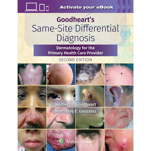 Goodheart's Same-Site Differential Diagnosis: Dermatology for the Primary Health Care Provider, (Hardcover)
