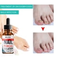thumbnail image 3 of 1-3pcs Nail Fungal Solution, Nail Repair for Fingernails Toenails, 3 of 5