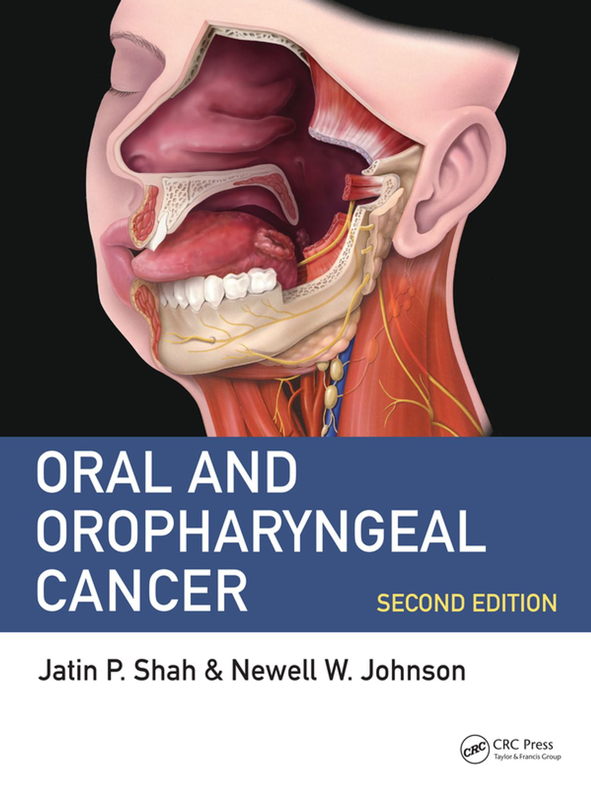 Oral and Oropharyngeal Cancer - eBook - Walmart.com - Walmart.com