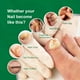 thumbnail image 4 of Esencia de tratamiento de hongos en las uñas Esencia de tratamiento de uñas para la eliminación profesional de hongos Likrtyny Cuidado Belleza, 4 of 9