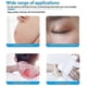 thumbnail image 4 of Losveo Silicone Scar Sheets For Face Wrinkles,Medical Grade Silicone Scar Sheets,Reusable Silicone Scar Strips for Scar Treatment, 4 of 5