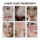 thumbnail image 3 of Black tea face mask cleanses and refines pores, brightens skin, and softens the complexion. (Cover-up mask), 3 of 4