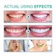 thumbnail image 5 of Coconut oil mouthwash to remove odor and teeth stains, fresh breath, care for, 5 of 5