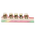 thumbnail image 1 of Modelo de enfermedad periodontal dental Modelo de enseñanza de estudio de enfermedades dentales para la escuela de odontología, 1 of 8