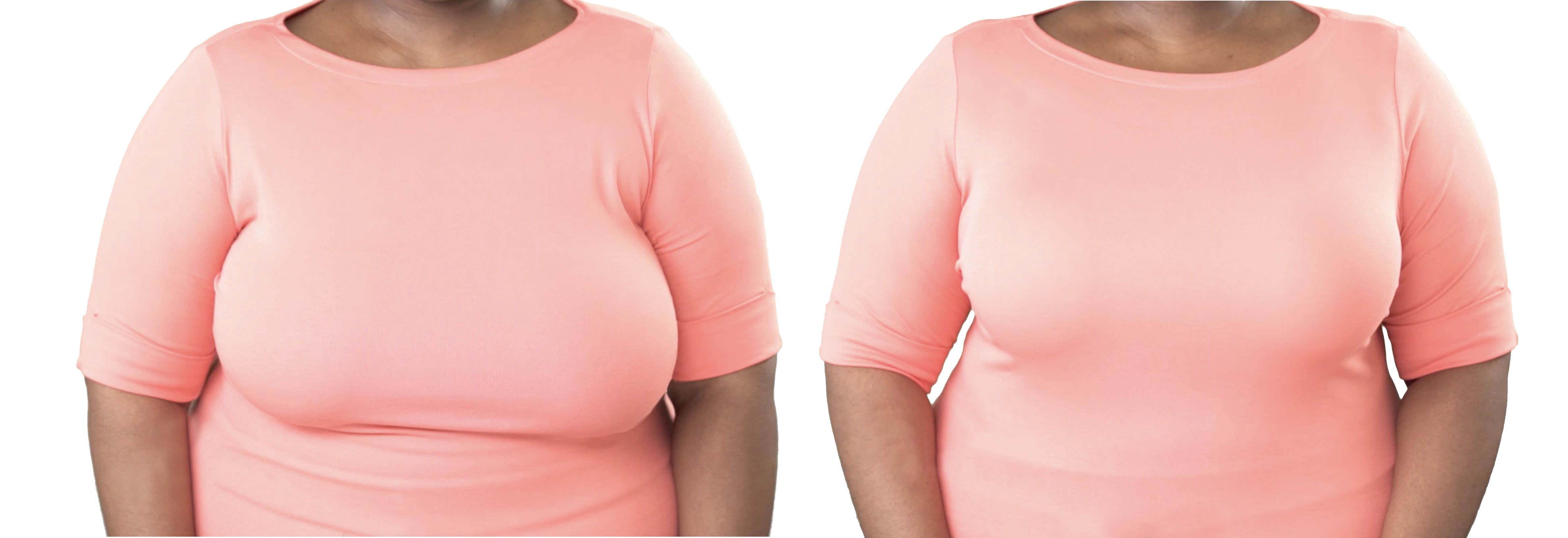 Dream By Genie Bra, Comfortable Bra with Breathable Fabric, Extra Large, As Seen on TV