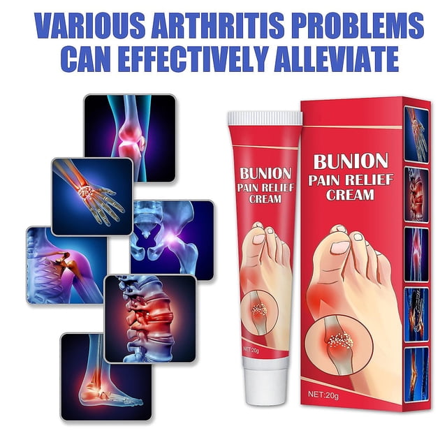 Crema para aliviar el dolor de juanetes, 20 g de crema para aliviar el dolor de juanetes y la hinchazón de los dedos de los pies, crema para aliviar el dolor de pies, cuello, rodillas, manos