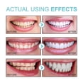 thumbnail image 2 of 1-3X Sodium Hyaluronate Teeth Whitening Toothpaste, Teeth Whitening with Baking Soda, 2 of 5