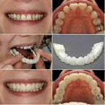 thumbnail image 5 of u200b4 Pack Snap On Smile Teeth Covers Cosmetic Dental Whitening Veneers Temporary Use Special Occasions Solutionu200b, 5 of 5