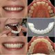 thumbnail image 5 of u200b4 Pack Snap On Smile Teeth Covers Cosmetic Dental Whitening Veneers Temporary Use Special Occasions Solutionu200b, 5 of 5