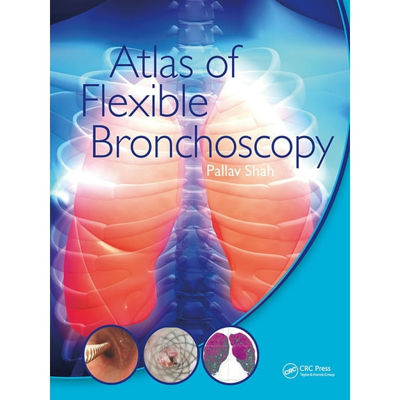 Atlas of Flexible Bronchoscopy (Paperback)