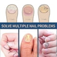 thumbnail image 2 of 96pcs Anti Fungal Nail Treatment-toe-fungus Onychomycosis Repair Sticker -, 2 of 5