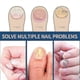 thumbnail image 2 of 96pcs Anti Fungal Nail Treatment-toe-fungus Onychomycosis Repair Sticker -, 2 of 5