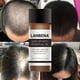 thumbnail image 5 of LANBENA potente crecimiento del cabello aceite esencial tratamiento reparación daño cabello Anti pérdida de cabello cuidado del cabello, 5 of 10