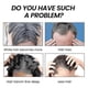 thumbnail image 2 of Bamboo Charcoal Shampoo Soap Deep Cleansing Scalp Strengthening Hair Strengthening urishing Repair Improve Dry, 2 of 4