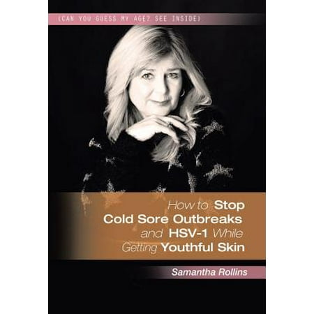 How to Stop Cold Sore Outbreaks and Hsv-1 While Getting Youthful (Best Way To Stop A Cold Sore)