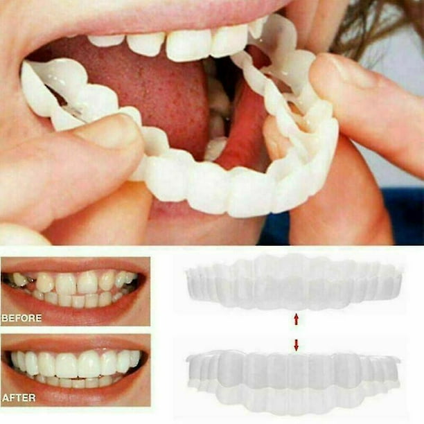 Sourire Accolades Snap On Upper Faux Dents Dentaires Facettes Dentier Cover  Set - Quantité 