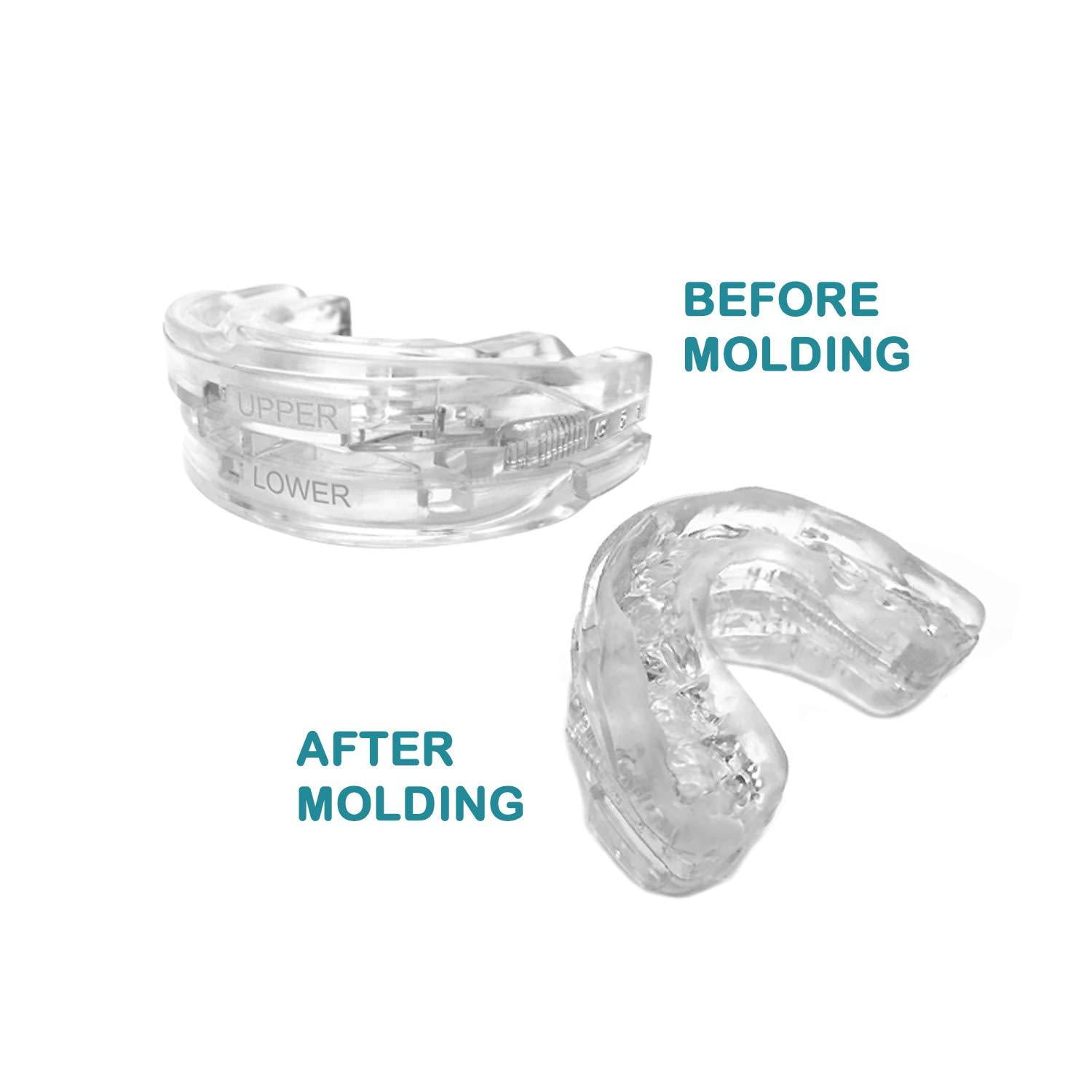 Pro Tech Dental Tranquility Pro 2 Adult Adjustable Bruxism Night Mouthpiece Sleep Dental Guard