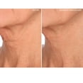 thumbnail image 4 of Parche antiarrugas para el cuello SiO Beauty NeckLift Overnight, 4 of 8