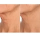 thumbnail image 4 of Parche antiarrugas para el cuello SiO Beauty NeckLift Overnight, 4 of 8