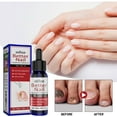 thumbnail image 1 of 2pcs Nail Repair Solution, Hands And Feet Nail Repair Moisturizing Clean And Remove Gray Nail Repair Solution, 1 of 5