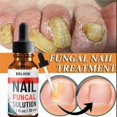 thumbnail image 3 of Nail Repair Liquid Hand And Foot Grey- Nail Care Repairing The Thickened Soft Nail Of Grey- Nail Liquid 30ml, 3 of 5