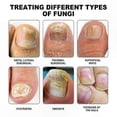 thumbnail image 5 of Gentle Nail Care Tool for Health and Repair, 5 of 5