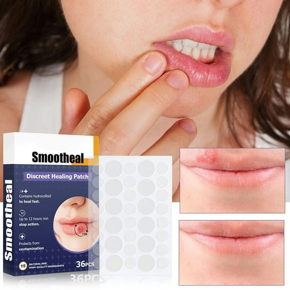 Sales Today Clearance! Cold Sore Smootheal Patches Cold Sore Discreet Healing Patch - A Patch That Protects And Conceals Cold Sores Deal of the Day!