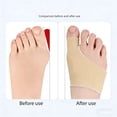 thumbnail image 4 of 2PCS Bunion Corrector for Women & Men, Big Toe Straightener with Splint & Pads, Comfortable & Breathable for Day/Night Support, Hallux Valgus Pain Relief Non-Slip Socks (S, Beige), 4 of 7