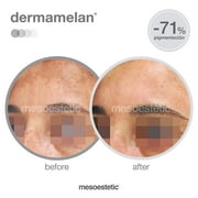 Mesoestetic Dermamelan Treatment Cream Pigment Control Solutions 30 g / 1.06 oz