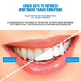 thumbnail image 4 of TeethWhiteningKit16LedBlueLightMouthTrayTeethWhiteningEnhancerLightInstrument, 4 of 5
