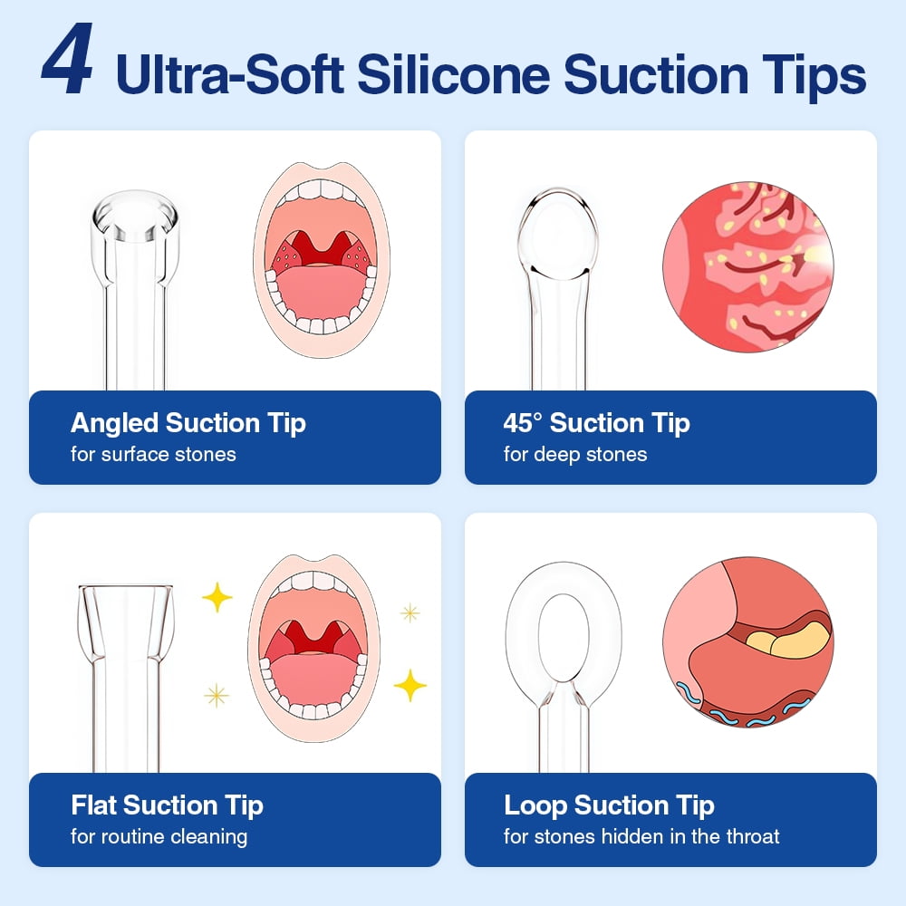 Upgraded Electronic Vacuum Tonsil Stone Remover with Built-in LED Light - Tonsil Stone Removal Kit with 3 Levels Suction,Tonsil Cleaner,Fight Bad Breath Oral Irrigator and 5X Magnifying Mirror,White