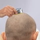 thumbnail image 5 of Afeitadora manual para cabeza calva con cuchillas de 8 capas, banda lubricadora de aloe, impermeable, fácil de limpiar, kit de viaje para hombres, afeitadora suave, afeitadora eléctrica alternativa p, 5 of 7