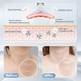 thumbnail image 5 of Electric Facial Massager, Portable High Frequency Heating Massage Face Lifting, 3 Modes 45°C for Beauty Skin Care Tools, EMS Massage Facial Conditioning, 5 of 6