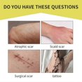 thumbnail image 2 of 2025 Latest Model Tattoo Cover Up Patch, Tattoo Cover Up Tape, Ultra Thin Patch, 2 of 5