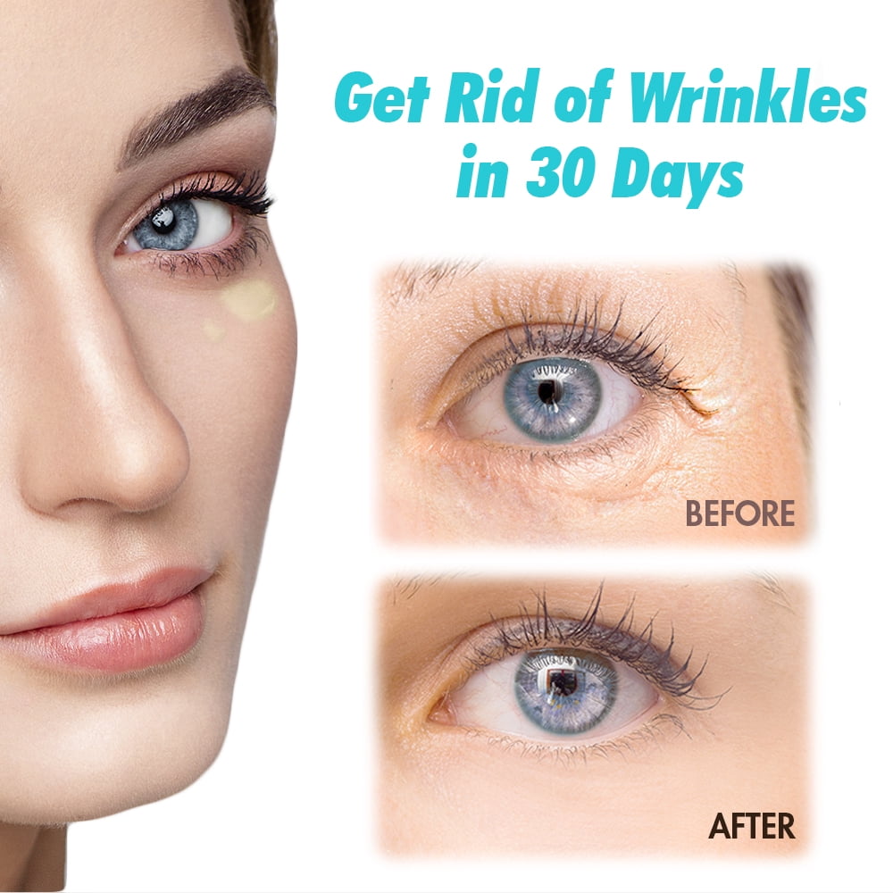 ebanel retinol